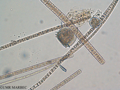 phyto/Scattered_Islands/all/COMMA April 2011/Phalacroma mitra (ancien Dinophysis sp1 -1)(copy)_thumb.jpg